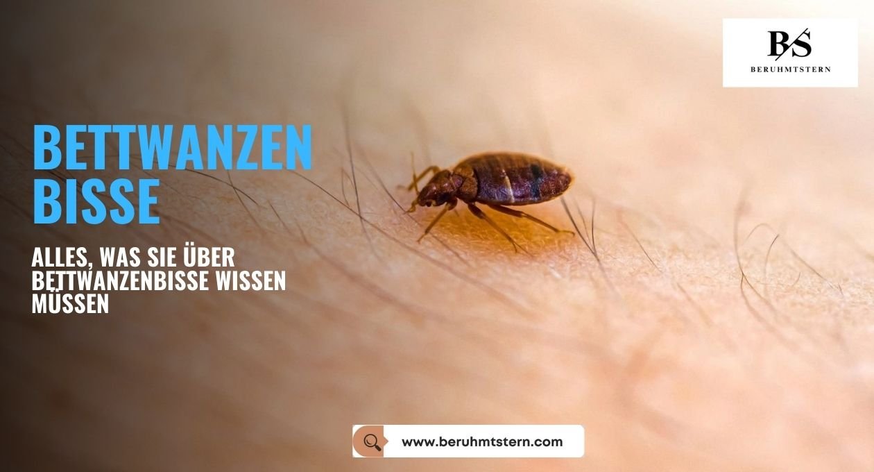 bettwanzen bisse