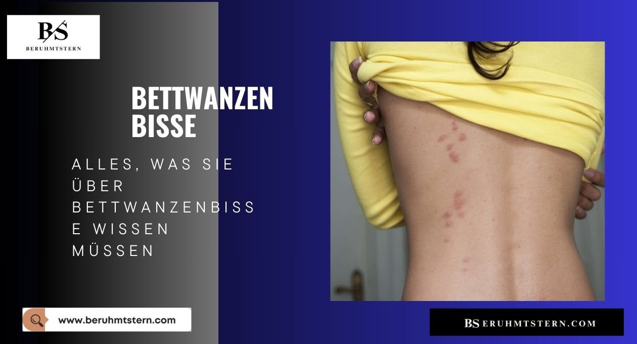 bettwanzen bisse