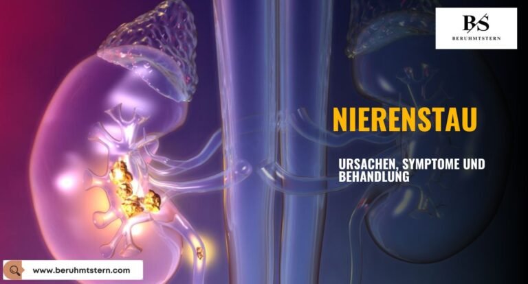 Alles, Was Sie über Nierenstau Wissen Müssen: Ursachen, Symptome Und