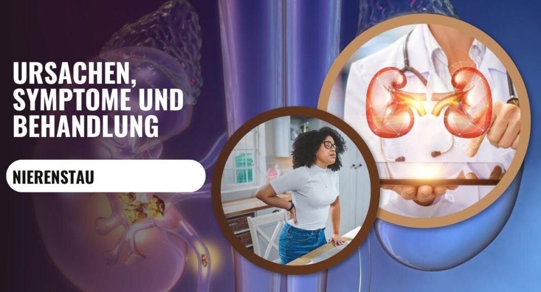 Nierenstau Beim Ungeborenen Baby Schwangerschaft Und Gesundheit beruhmtstern.com