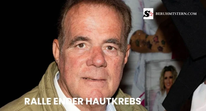 Ralle Ender Hautkrebs